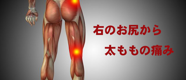 お尻から太ももの裏側の痛み