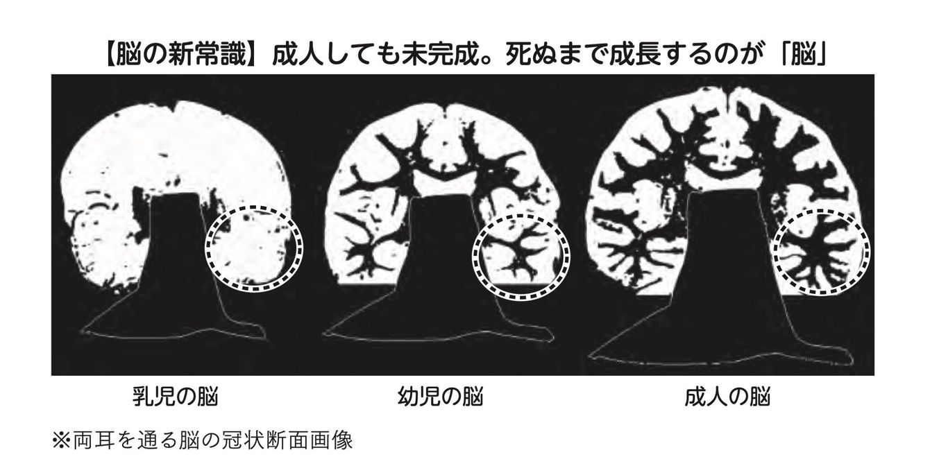 神経細胞の枝ぶり