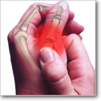 親指の痛み
